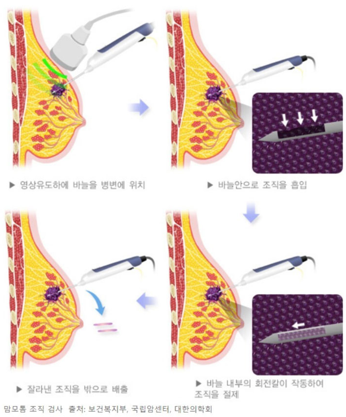 수술순서